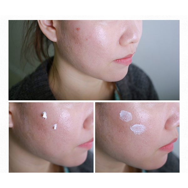 Загоювальний крем COSRX Centella Blemish Cream M0653 фото