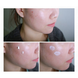 Загоювальний крем COSRX Centella Blemish Cream M0653 фото 2