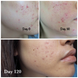 Загоювальний крем COSRX Centella Blemish Cream M0653 фото 4