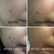 Загоювальний крем COSRX Centella Blemish Cream M0653 фото 3